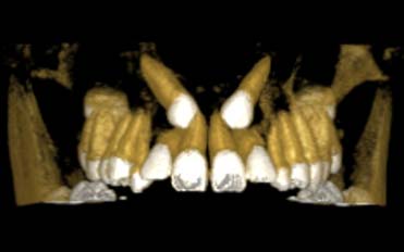 Você está visualizando atualmente Mensagens Subliminares na Ortodontia