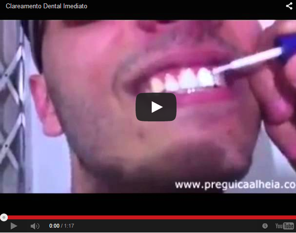 Você está visualizando atualmente Clareamento Dental – Não faça isso!