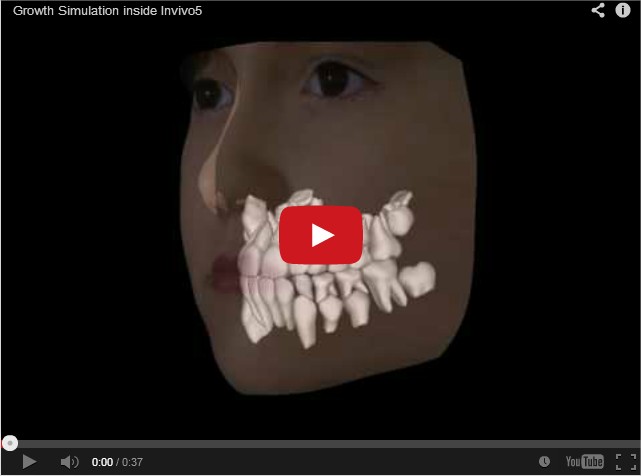 Você está visualizando atualmente Surpreendente: Veja quando o seu filho vai trocar os Dentes!