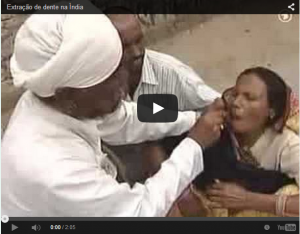Leia mais sobre o artigo SORTE do DIA: Você NÃO está na Índia – A S S U S T A D O R A   Extração de um dente na Índia