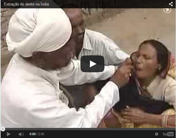 Você está visualizando atualmente SORTE do DIA: Você NÃO está na Índia – A S S U S T A D O R A   Extração de um dente na Índia