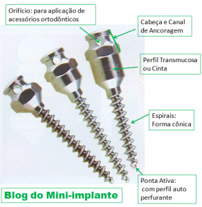 Parafuso_Mini-implante Blog do Mini-implante