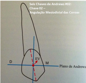 Leia mais sobre o artigo Seis Chaves de Andrews #02 – Chave 02 – Angulação Mesiodistal das Coroas: