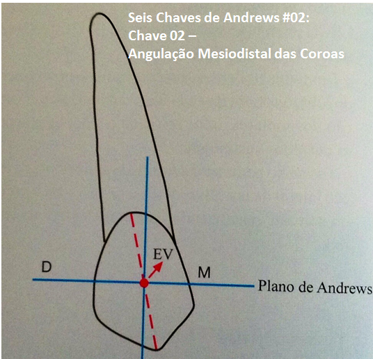 Leia mais sobre o artigo Seis Chaves de Andrews #02 – Chave 02 – Angulação Mesiodistal das Coroas: