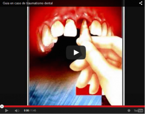 Leia mais sobre o artigo Quando se ARRANCA  um dente acidentalmente, veja o que fazer!