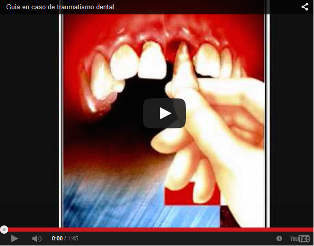 Você está visualizando atualmente Quando se ARRANCA  um dente acidentalmente, veja o que fazer!