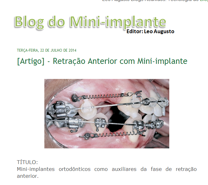 blog do mini