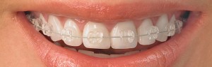 ortodontia_em_guarulhos
