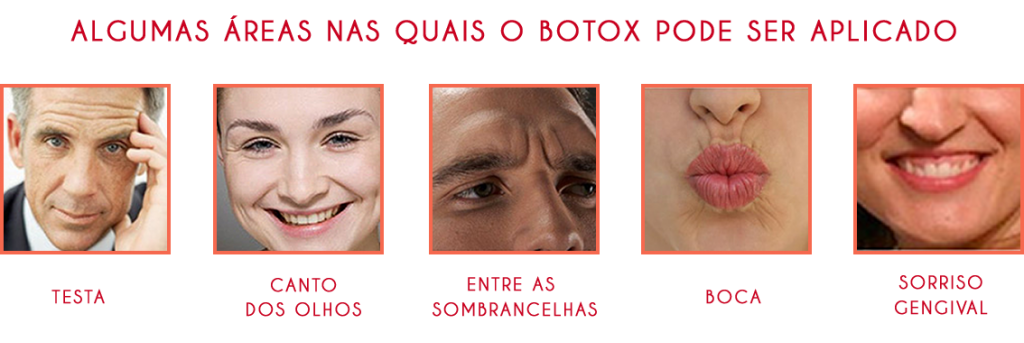 botox_faces1