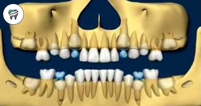 Sequência e cronologia de erupção/irrupção dos dentes — FANTÁSTICO VÍDEO